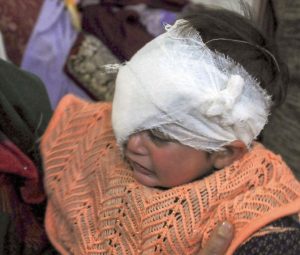 الأطفال ضحايا الإرهاب الهندي في كشمير المحتلة