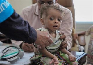 هشدار یک سازمان بین‌المللی در خصوص تهدید جانی میلیون‌ها کودک در یمن