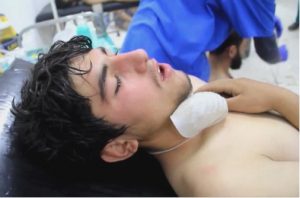 ادلب کے معرکوں میں کیمیائی ہتھیاروں کا استعمال، اقوام متحدہ کی تشویش